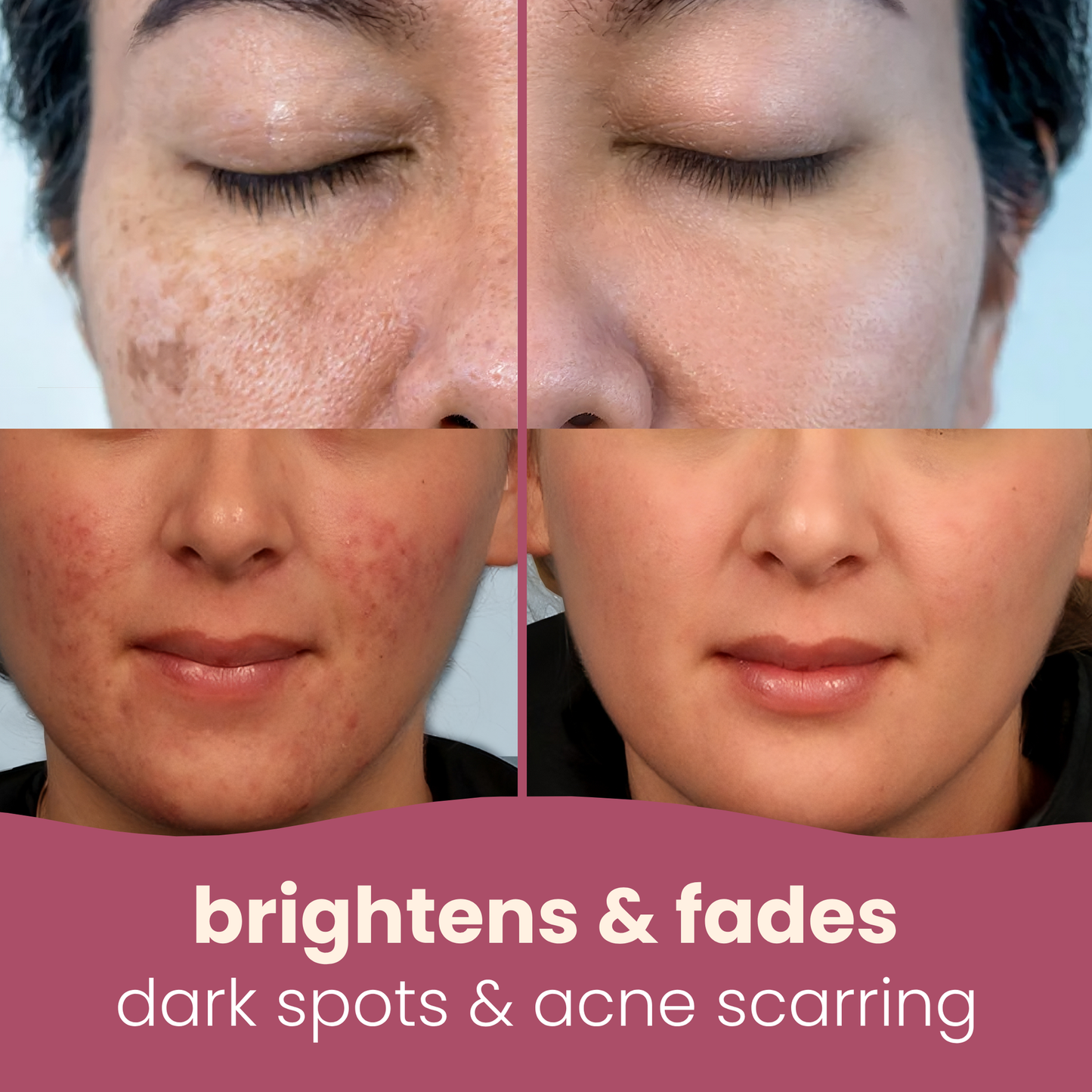 Premium Korean Cleansing Pads with Kojic Acid & Turmeric